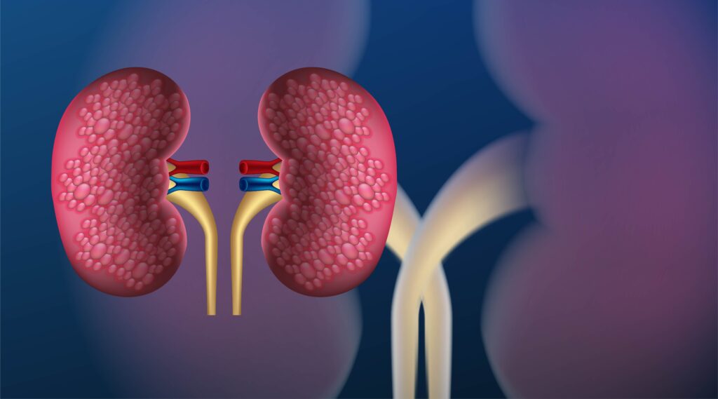 Diabetic nephropathy pathophysiology