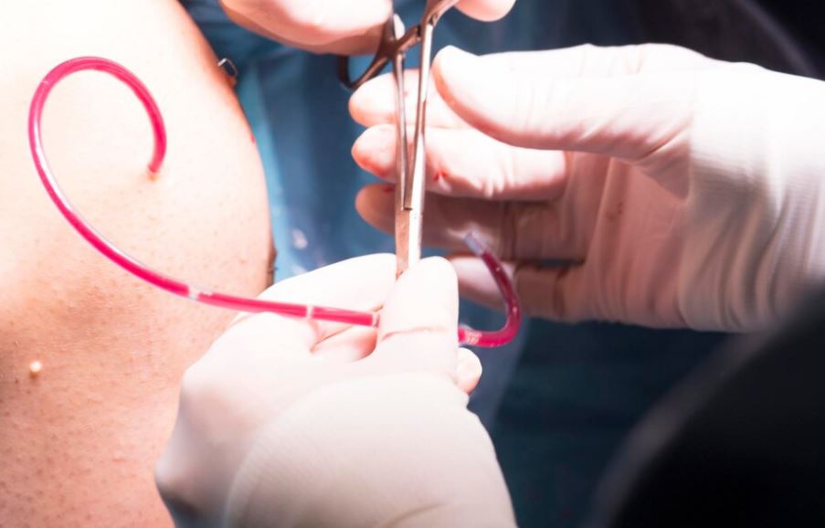 adhesiolysis surgery