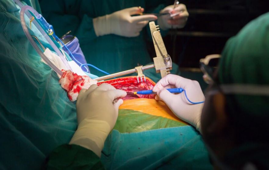 rectocele surgery