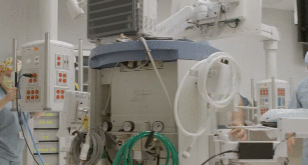 Dialysis graft causes aneurysm